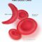 Diagram of sickle cell